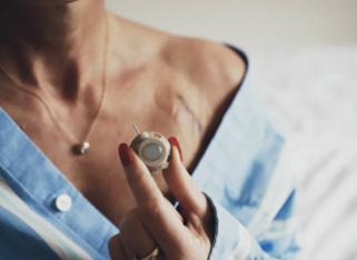 A woman in a blue shirt holds a medical device, revealing a surgical scar on her shoulder