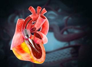 3D illustration of a human heart, showing arteries and chambers
